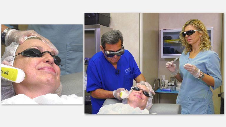 ФОТООМОЛОЖЕНИЕ IPL. УХОД ЗА ЛИЦОМ