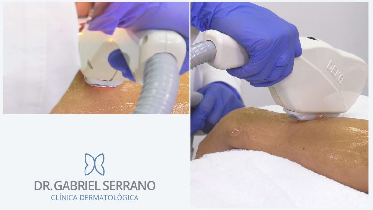 ИНТЕНСИВНЫЙ ИМПУЛЬСНЫЙ СВЕТ