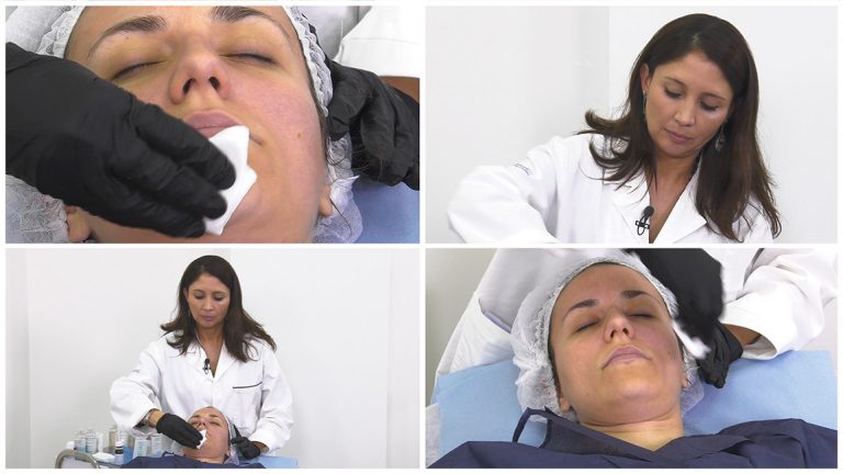 АЗЕЛАИНОВЫЙ ПИЛИНГ