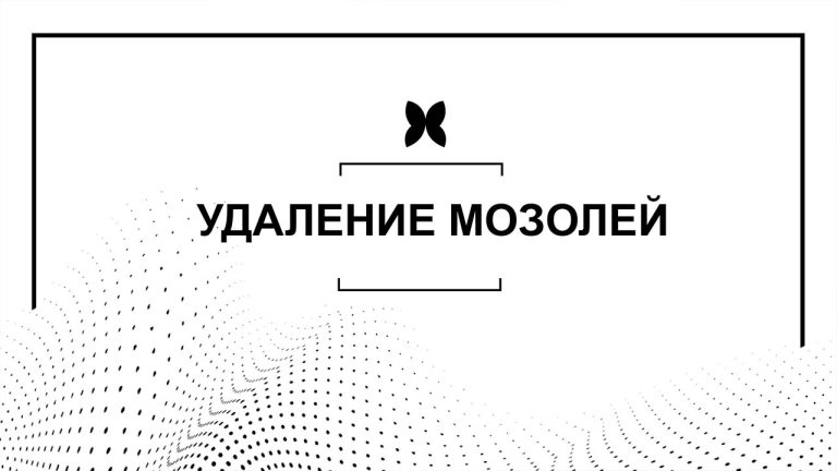 УДАЛЕНИЕ МОЗОЛЕЙ