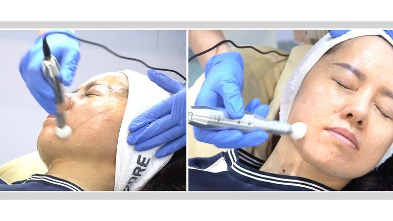 Treatment 4